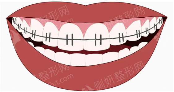 济南省立医院口腔科牙齿正畸