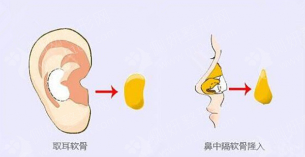 贵阳市隆鼻美容整形排名前十的医院