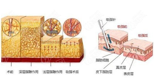 陕西人民医院美容整形科