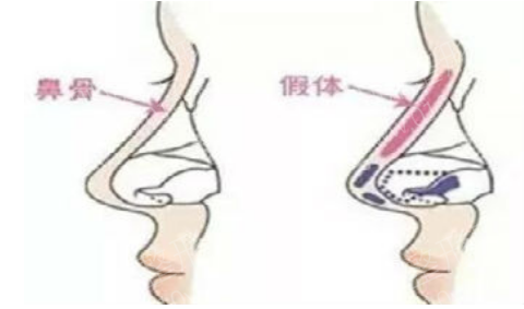 重庆陆军军医大学西南医院整形科