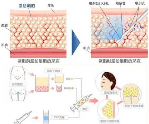 天门第一人民医院整形科