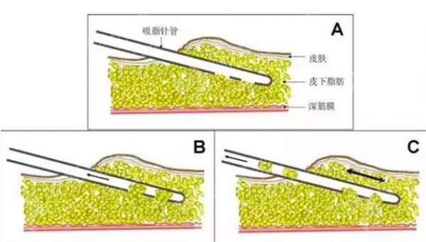 北京奥北中生殖整形科