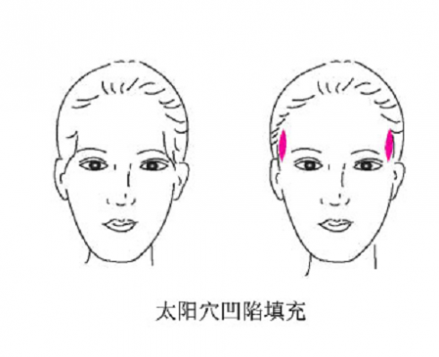 泰安肥城中整形科