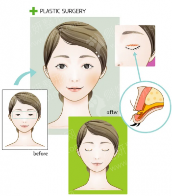 广州伊丽莎白美容整形科