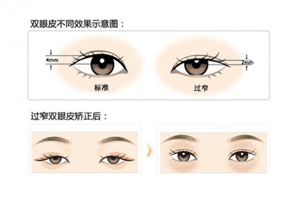 广州奢媛整形医院好不好