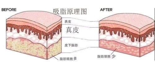 长沙恩喜医疗美容医院怎么样?