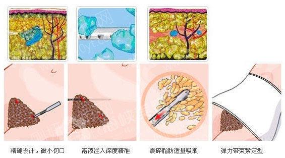 南京第一医院整形科在哪里