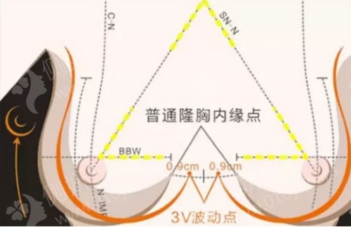 雅芳亚整形医院价目表