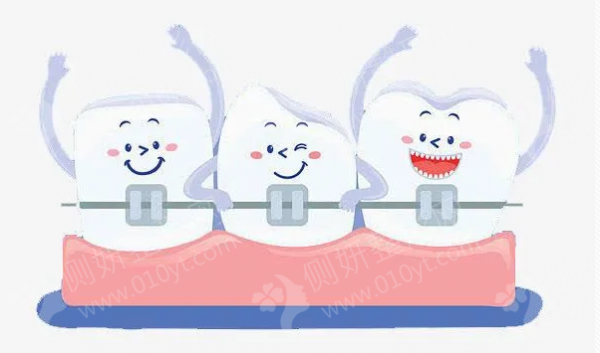 天津口腔医院矫正牙齿大概多少钱
