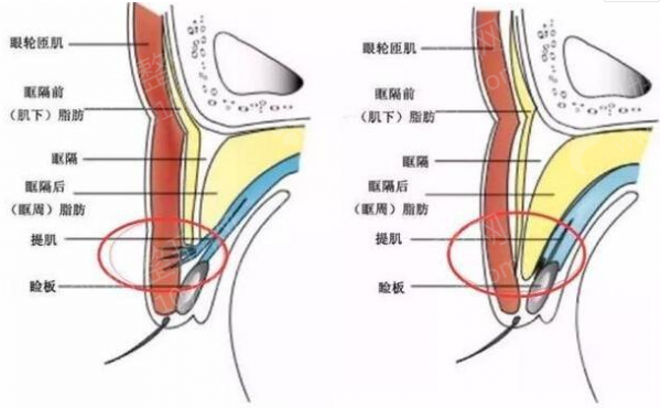 杭州浙一医院有做热玛吉吗