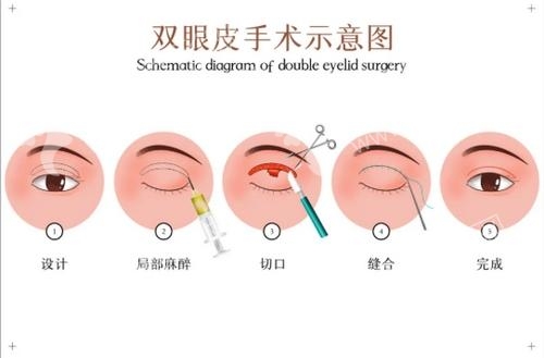 广州美博汇整形医院