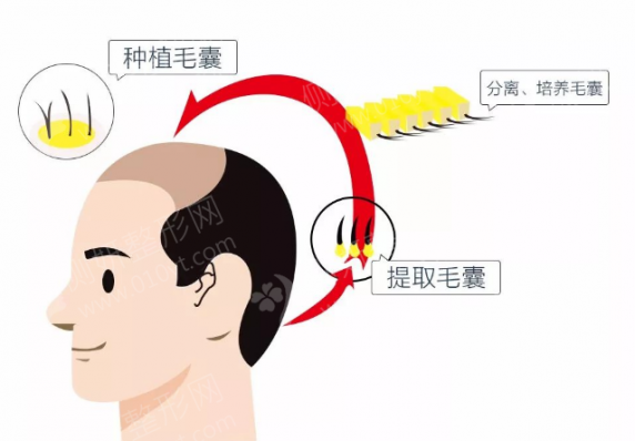 武汉市第一医院植发