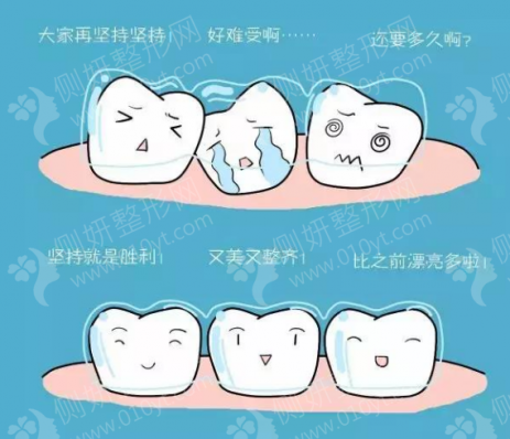 东莞市企石医院口腔科矫正牙齿