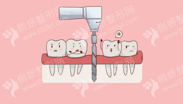 昆明吴氏嘉美泽众口腔门诊部牙齿矫正