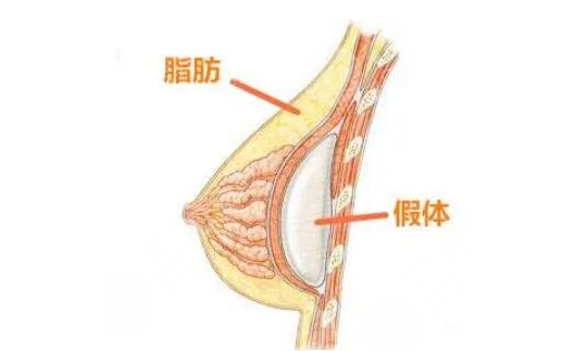 浙江中医药大学附属第二医院整形科假体隆胸