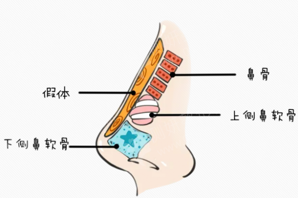 哈尔滨医科大学附属第一医院整形科硅胶隆鼻