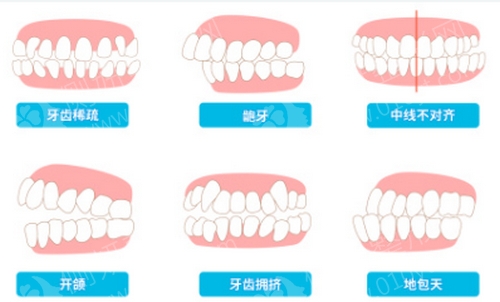 陕西省友谊医院口腔科牙齿矫正