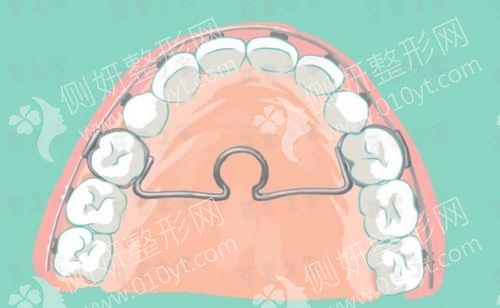 浙江大学医学院附属儿童医院口腔科牙齿种植