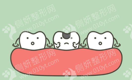 广东药学院附属第一医院口腔科牙齿种植