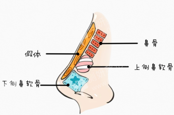 上海仁爱医院整形科鼻部修复