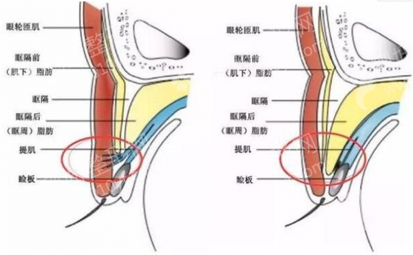 嵊州人民医院整形科