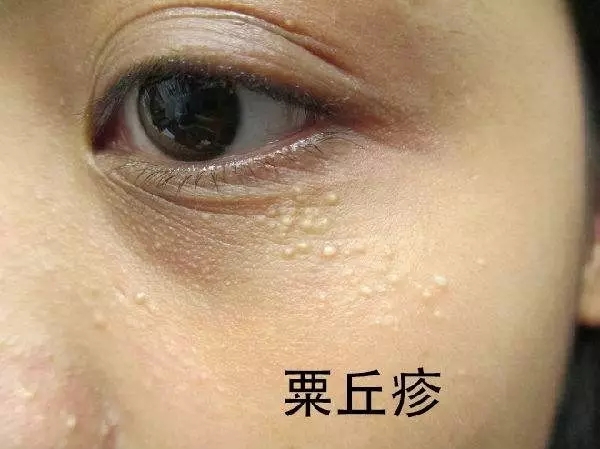 韩国曼的整形医院眼睛修复怎么样？